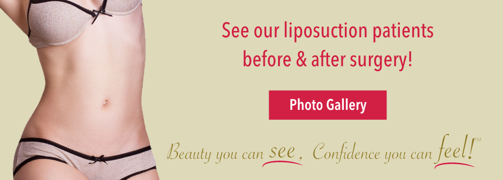 Liposuction before and after gallery - Dr Firouz