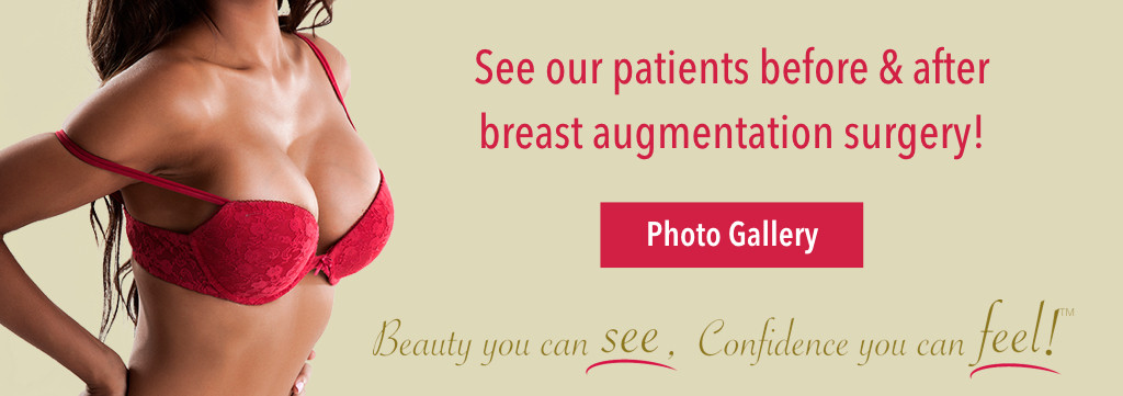 Breast augmentation photo gallery